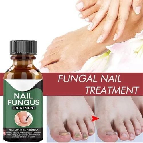 Fast Nail Fungus Treatment Serum - Image 2