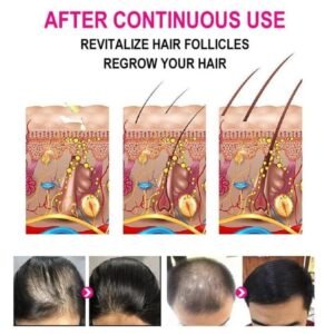 Anti-grey Hair Serum 30ml