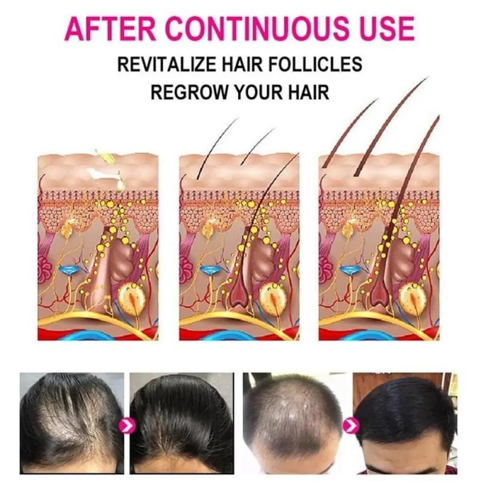 Anti-grey Hair Serum 30ml