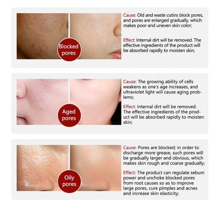 Rorec Moisturizing Anti Wrinkle Rice Face Serum for Open - Image 4